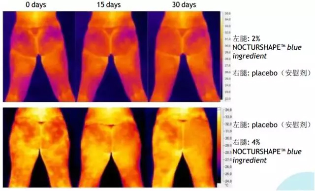 Nocturshape生物钟减肥疗法，24小时瘦不停！