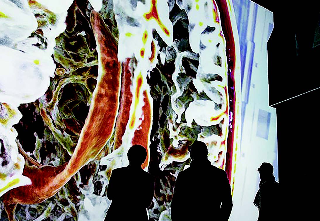 图 2：大脑 MRI 数据集的电影渲染使学生和公众能够观看 3D 数据。图片由 Franz Fellner/ 开普勒大学医院提供。