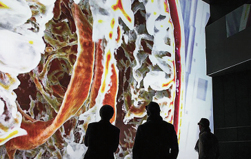 图 2：大脑 MRI 数据集的电影渲染使学生和公众能够观看 3D 数据。由 Franz Fellner / 开普 勒大学医院提供。