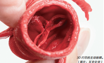 3D 打印的主动脉瓣。 （图片：瓦克化学）