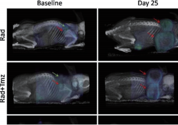 图 1：PET/CT 成像显示在治疗开始时和 25 天后，四种治疗组合 中的 18F-FDG 肿瘤摄取。红色箭头表示开始和第 25 天的肿瘤位 置，绿色箭头表示棕色脂肪组织（BAT）中典型的 18F-FDG 摄 取位置。根据知识共享许可协议从参考文献中复制 [1]。（https:// creativecommons.org/licenses/by/2.0/）