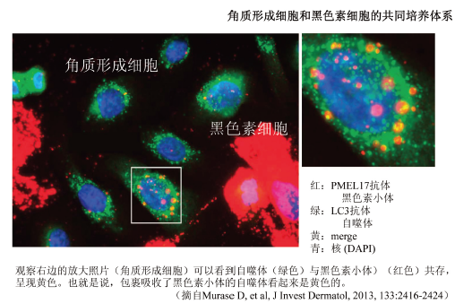 图2. 角质形成细胞中的自噬体和黑色素小体