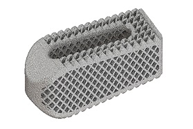 Osseus推出3D打印的钛经椎间孔腰椎椎间融合器
