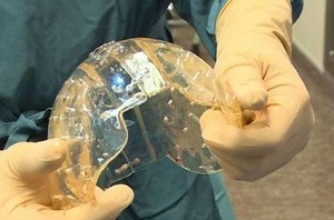 个性化医疗风起云涌 3D打印火热医疗应用大盘点