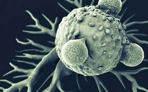 “私人订制”的个体化肿瘤治疗方案：异种移植瘤模型