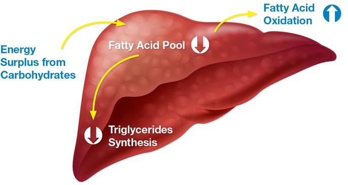 Omega-3帮助改善非酒精性脂肪肝
