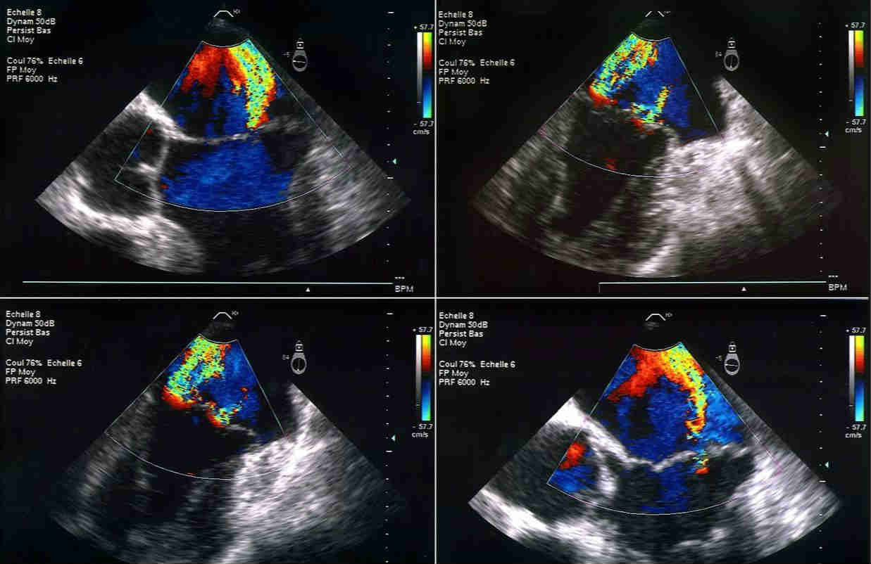 飞利浦5.37亿美元收购心脏病医疗设备制造商