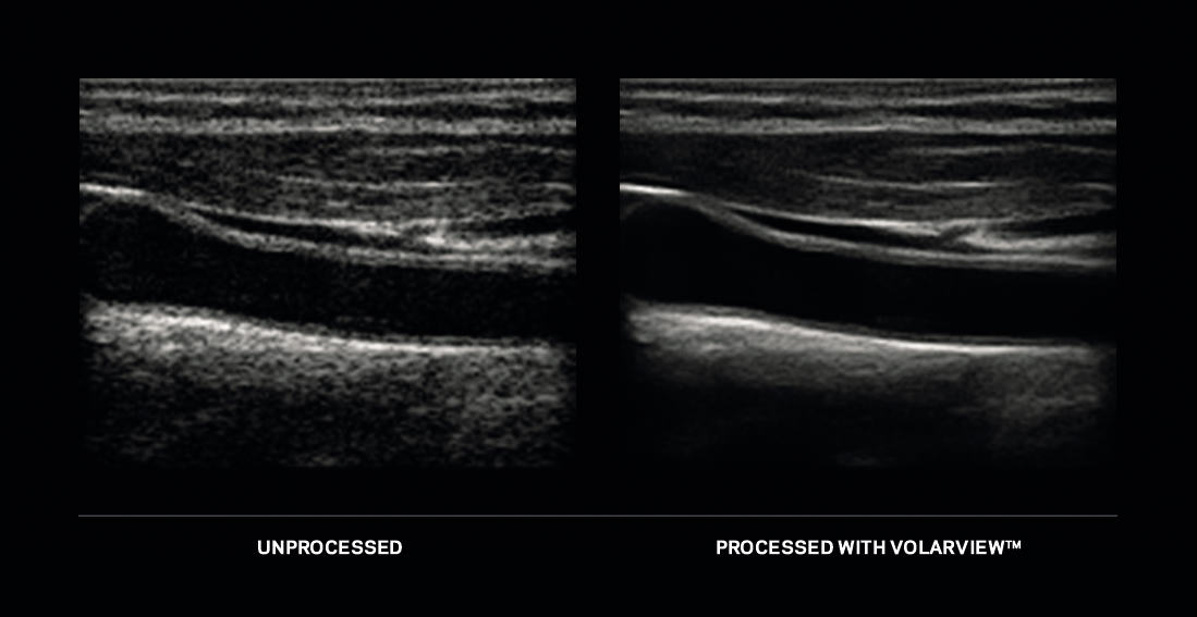 康泰瑞影展出手持超声及骨科影像增强解决方案