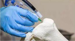 医疗3D打印市场规模将超96亿美元