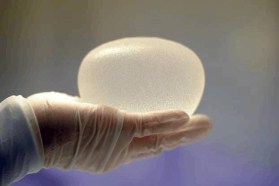 法国医生敲警钟：艾尔建Biocelle型号隆胸假体可能致癌