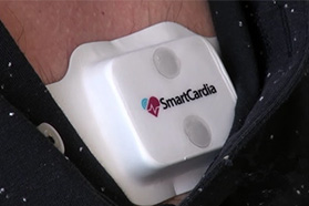 Smartcardia无线电子贴片将取代急诊监测仪器
