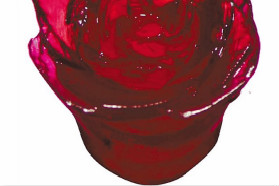 换器官像换电池？浙大教授发明新型生物3D打印方法