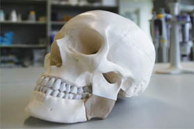 通过高性能聚合物的增材制造生产个体化植入物