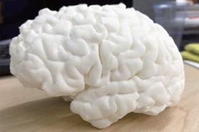 玩转医疗领域——3D打印时代大步走来