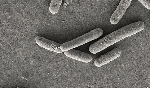 AB-BIOTICS and Kaneka Probiotics’ cognitive health strain gains GRAS status