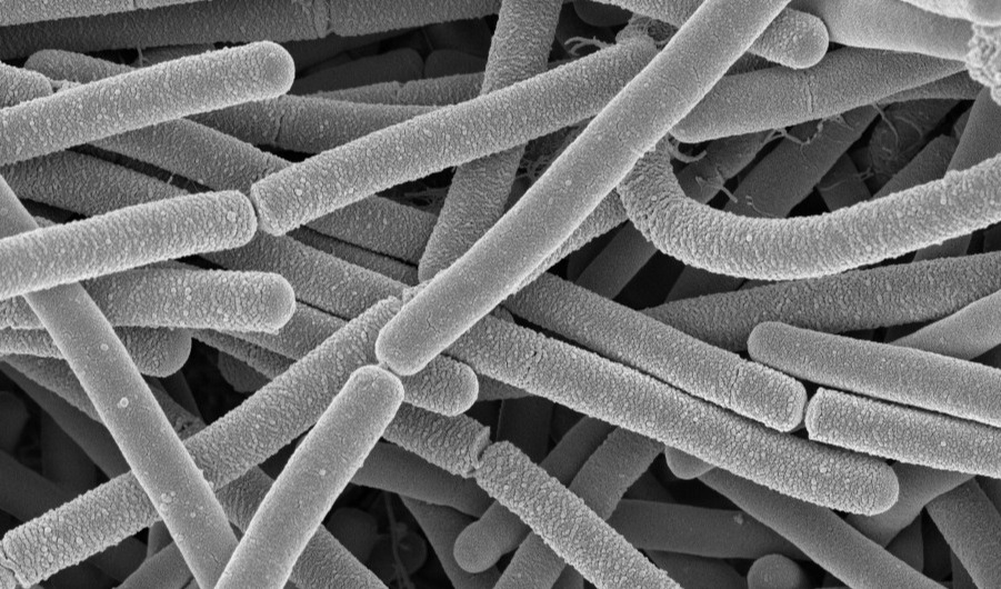Women’s health: AB-BIOTICS, KANEKA PROBIOTICS reveal results of new clinical study