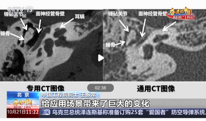 从“跟跑”到“领跑” 国产医疗装备“利器”层出