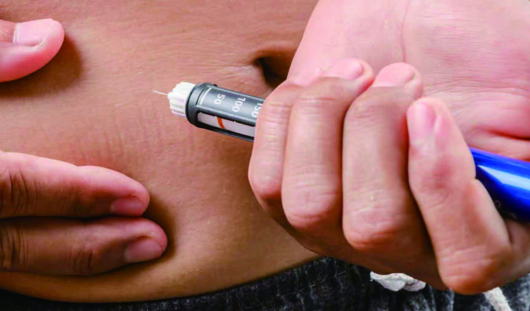 医疗注射笔：小笔管撬动大市场，国产替代正当时