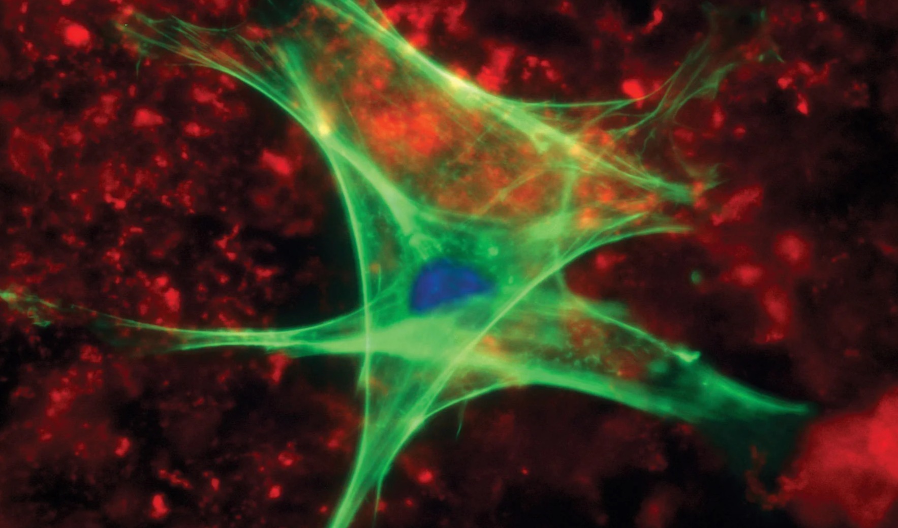 中紫外激光实现室温连续运行，蓝宝石衬底推动产业化