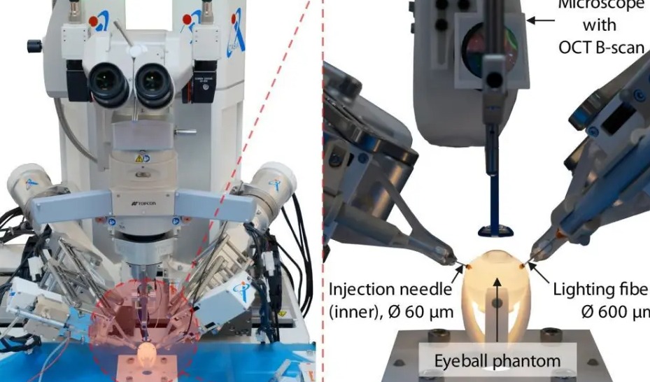 眼底注射更精准！我国科研团队研发新型手术机器人