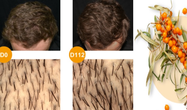 Cosmetic ingredient clinically evaluated to support the look of fuller hair