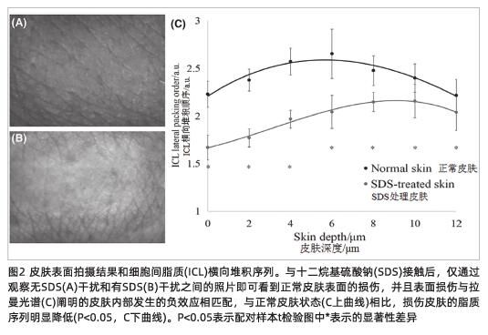 表面活性剂对人体皮肤刺激机制的拉曼光谱学研究