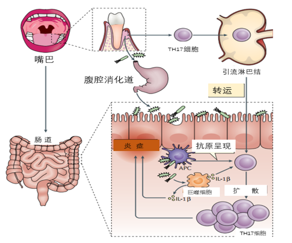 综述：关联牙周炎及其合并症 的局部和全身机制（节选）