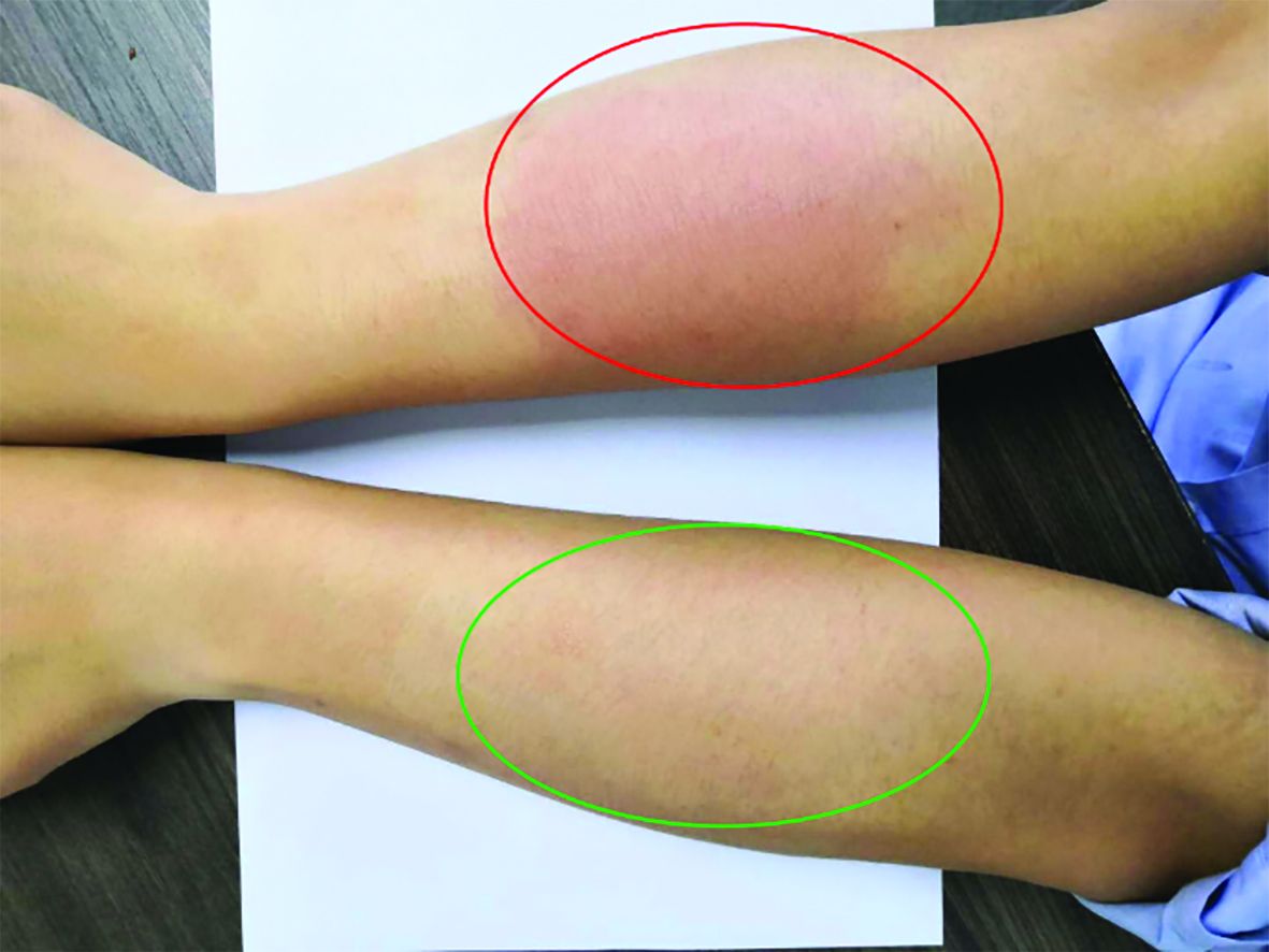 “圣药”卡瓦胡椒，抗炎舒敏功效测试     非常规舒缓机理，更强效快速舒缓