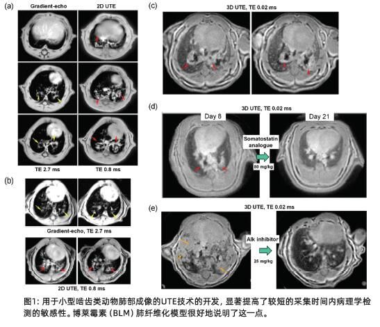 无创临床前磁共振肺成像技术发展，推动药物研发