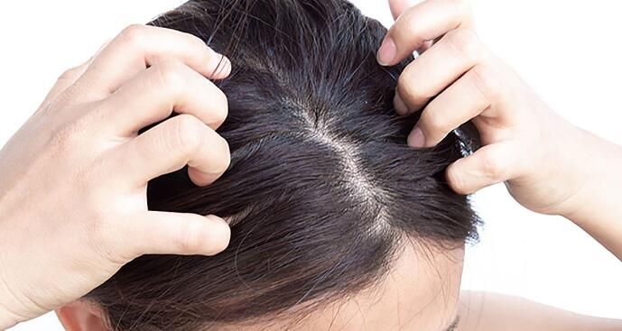 头皮上的微观世界