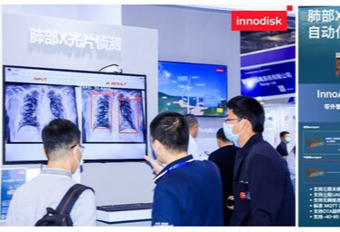 宜鼎国际最新肺部X光片侦测自动化边缘 AI 解决方案加速医疗诊断