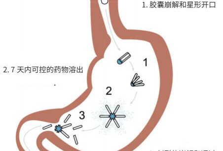 原料药固定剂量组合的创新剂型（下）