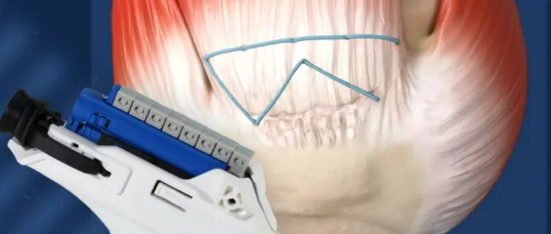 骨科巨头施乐辉31亿元收购，加码肩袖修复赛道